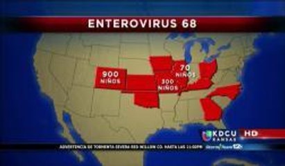 Probables casos de enterovirus EV-D68