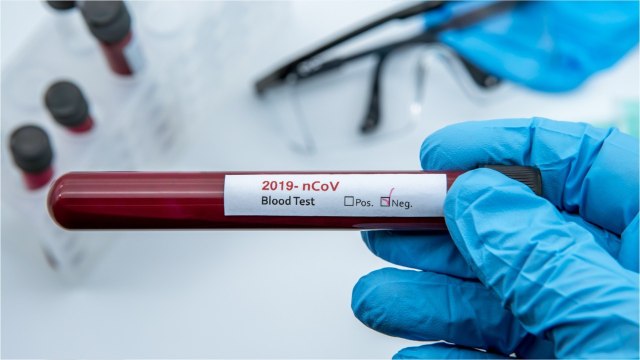 Le laboratoire Roche annonce un test sérologique d’ici deux semaines