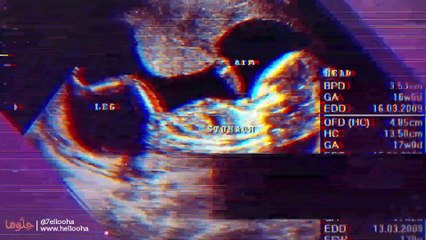 ما سبب عدم ظهور الجنين داخل كيس الحمل؟