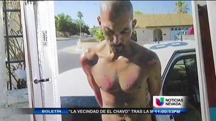 Hombre dice ser víctima de brutalidad policíaca