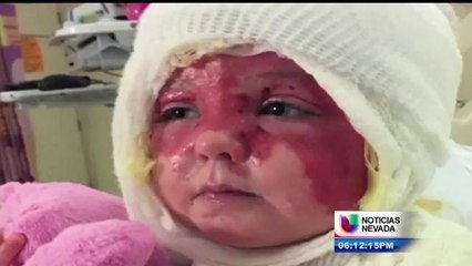 MADRE ACUSADA DE QUEMAR A SU HIJA