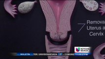 Cancer cervical: Un asesino silencioso