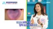 [HEALTHY] You can tell the health of your blood vessels by the color of your tongue?, 기분 좋은 날 211117