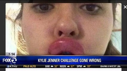 New Kylie Jenner Beauty Challenge Gone Wrong Sweeps Internet