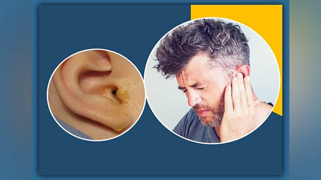 कान से पानी निकलने की परेशानी को दूर कर तुरंत देगा राहत। कान से पानी निकलने के कारण और उपाय। Boldsky