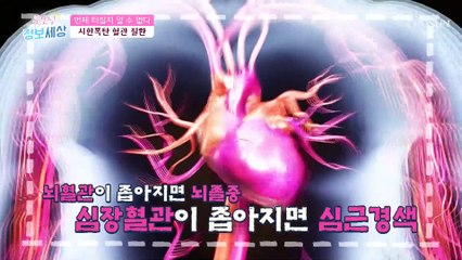환절기에 ˹심뇌혈관 질환˼ 발병률이 더 높은 이유 ✓ TV CHOSUN 211117 방송