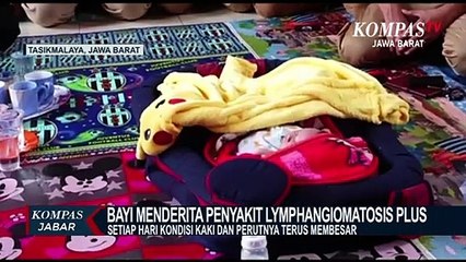 Bayi 10 Hari,  Bengkak Perut dan Kaki