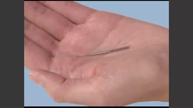 Mujeres locales reportan efectos dañinos de implante anticonceptivo