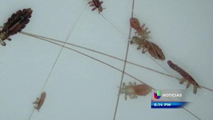 ¿Cómo prevenir los piojos en los niños?