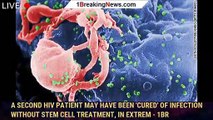A second HIV patient may have been 'cured' of infection without stem cell treatment, in extrem - 1br