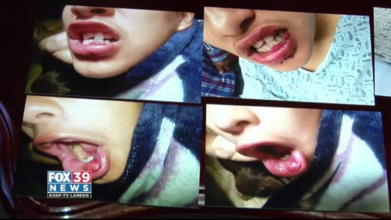 Mother concerned about incident involving her child