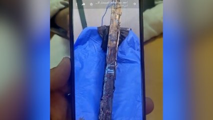 استخراج لوح خشبي بطول متر ونصف من جسد شاب بسوهاج