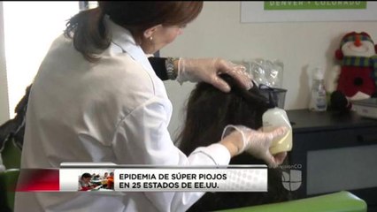 Epidemia de súper piojos en 25 estados