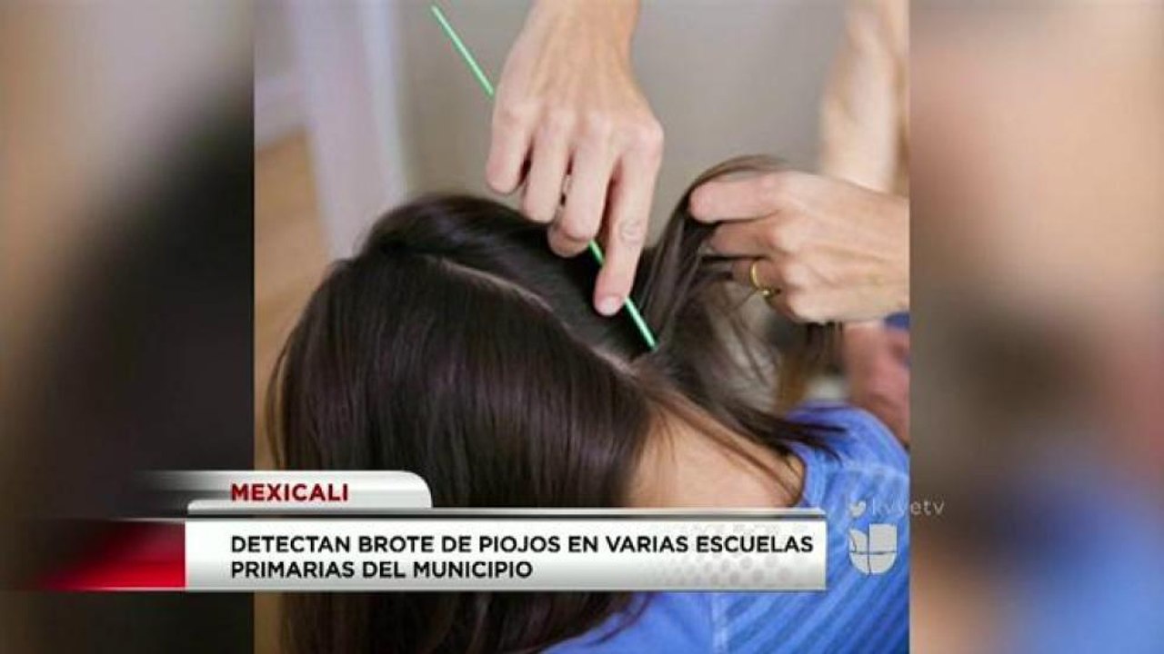Brote de piojos.