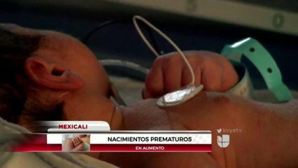 Bebés prematuros.