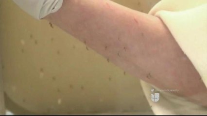 Virus del Zika Provoca Alarma en Estados Unidos
