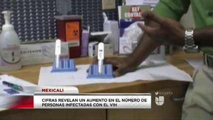 Aumenta la detección de VIH.