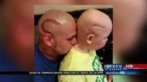 Hombre se tatúa en la cabeza cicatriz similar a la de su hijo