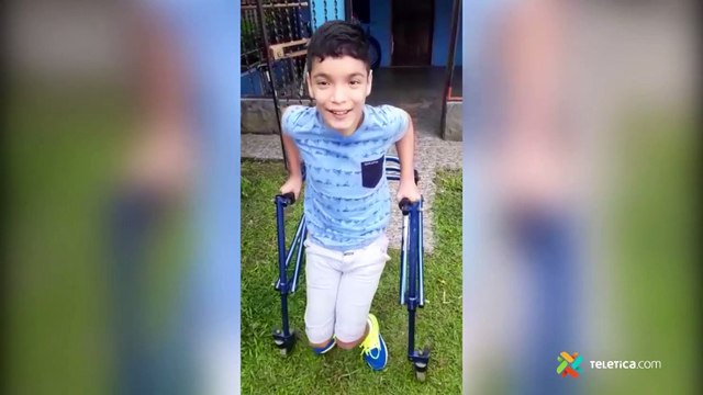 tn7-Niño requiere de su ayuda para poder caminar-v2-171121