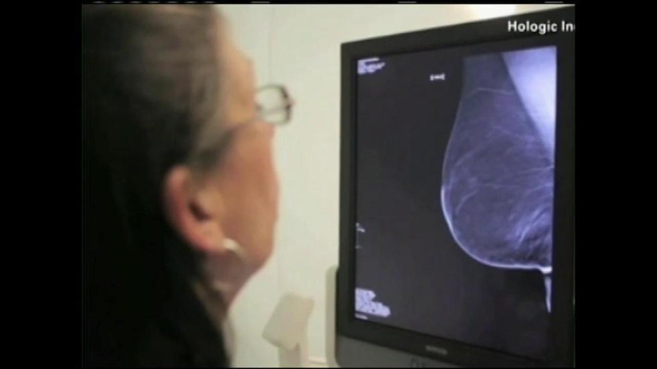 Mes de la prevención contra el cancer de mama