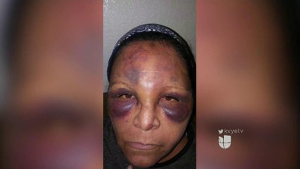 Investigan brutal ataque a mujer