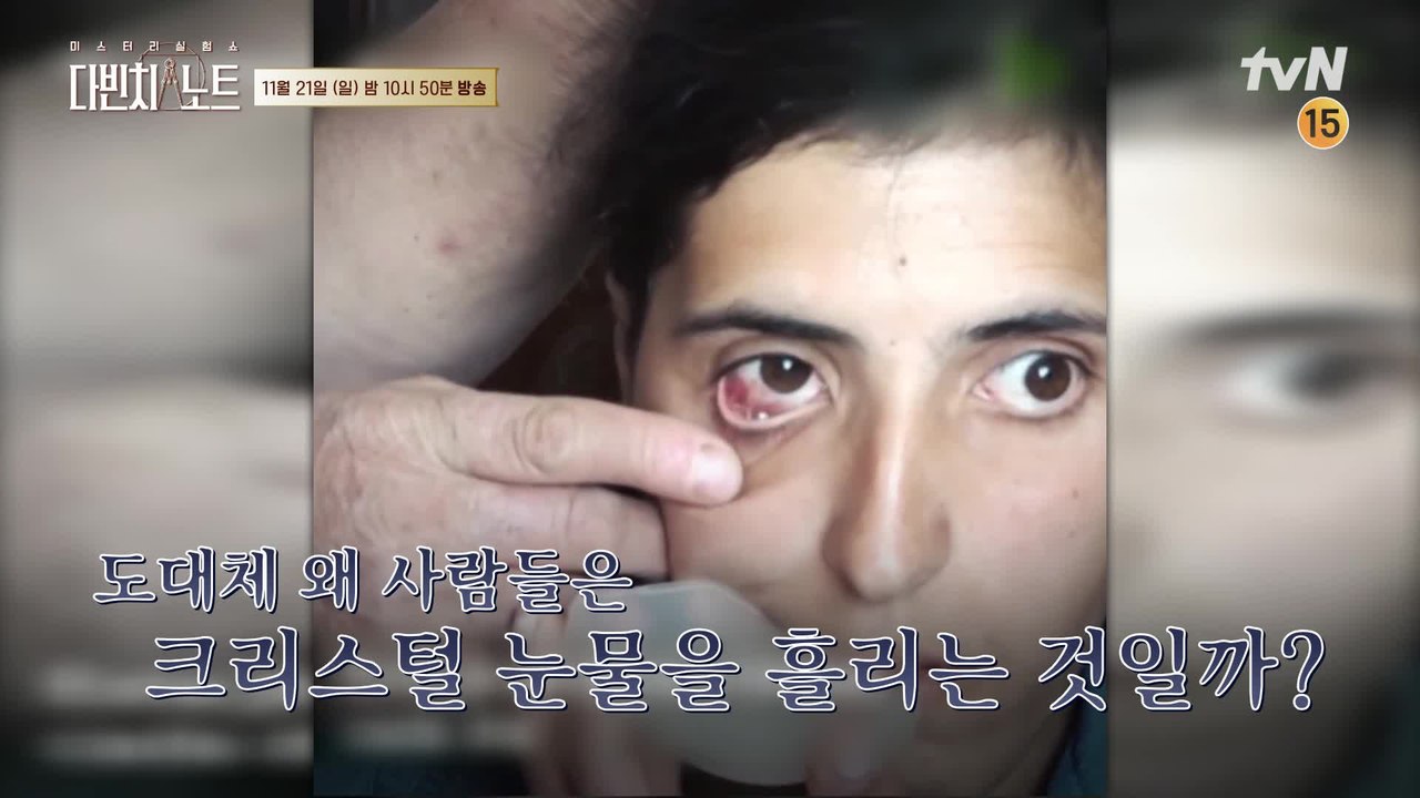 [선공개] 충격! 눈에서 떨어지는 보석 실화? 미스터리 VS 과학