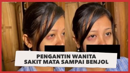 Pengantin Wanita Sakit Mata Sampai Benjol, Hasil Make Up Disorot: Parah Banget!