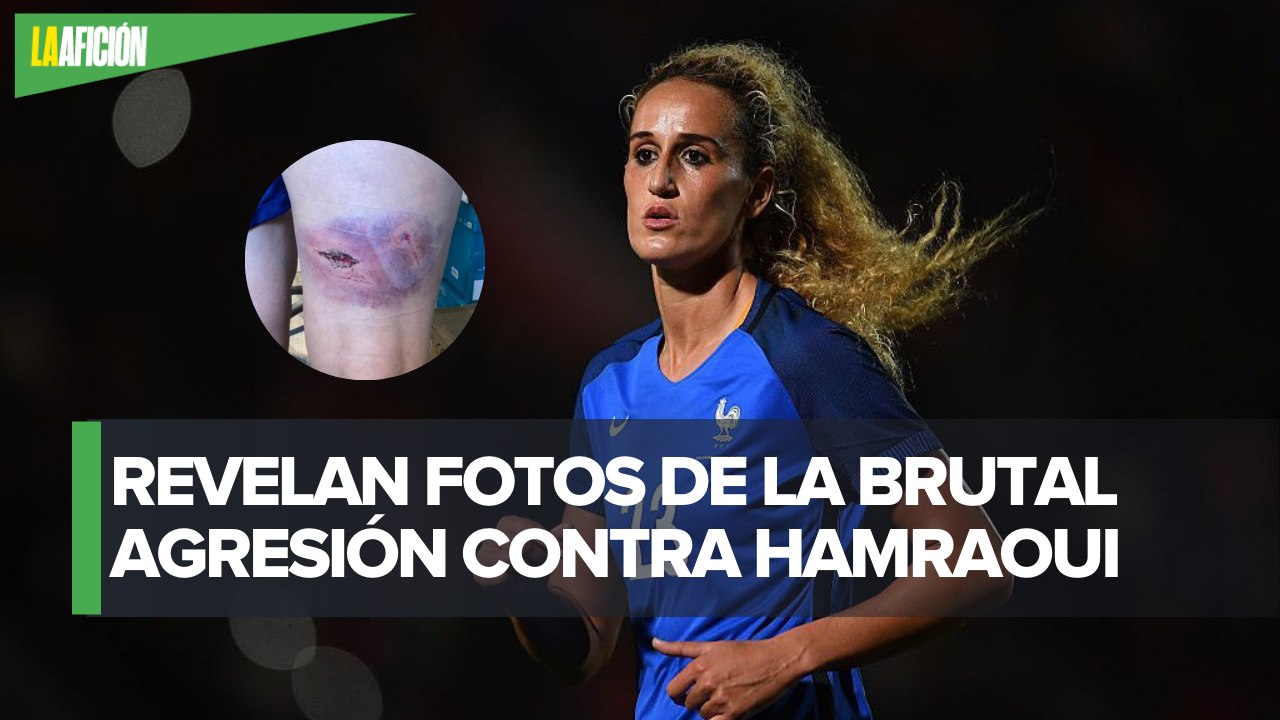 Kheira Hamraoui muestra las lesiones de su violenta agresión