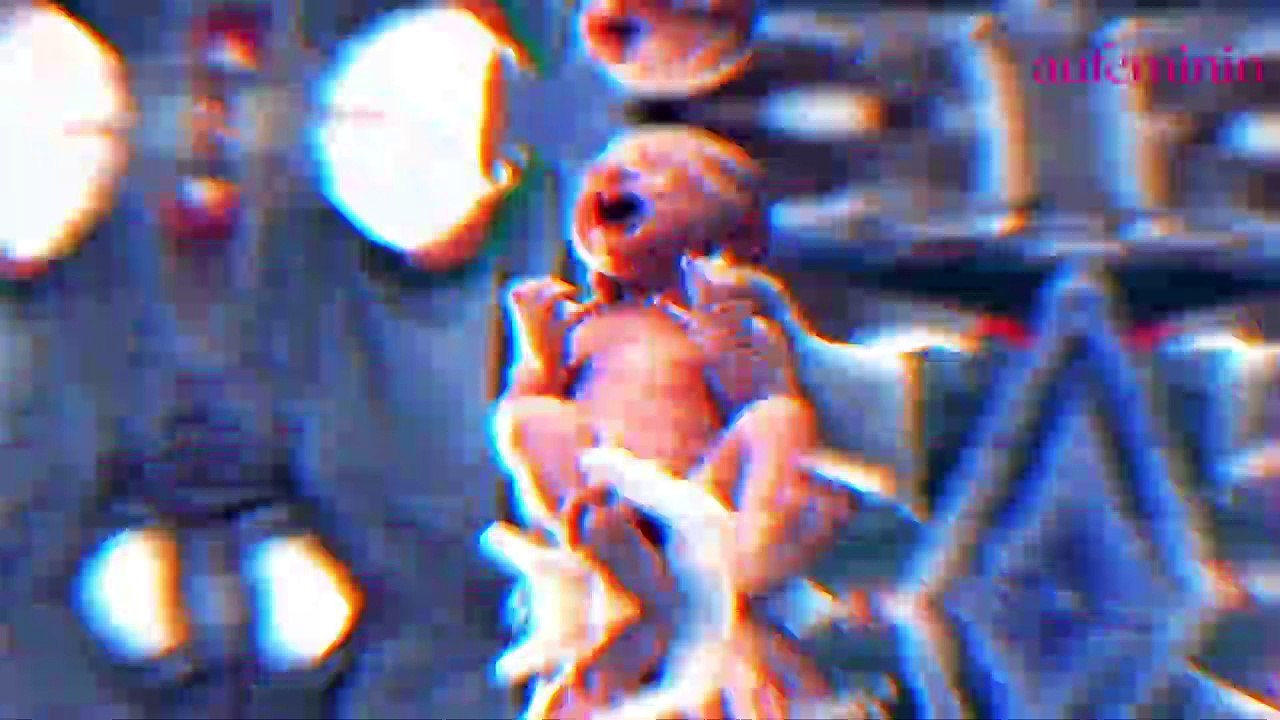 Accouchement : il filme l'impressionnante naissance d’un bébé encore dans sa poche des eaux (vidéo)