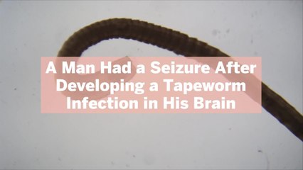 A Man Had a Seizure After Developing a Tapeworm Infection in His Brain—What to Know About Cysticercosis