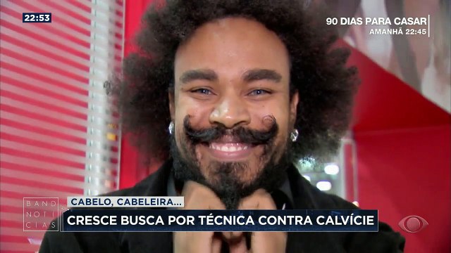 Para alguns homens, perder o cabelo é uma experiência difícil, que afeta a autoestima. Por isso, a procura por técnicas que ajudam a dar adeus à calvície não para de crescer aqui no Brasil.