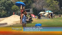 Tipos de Cáncer de piel