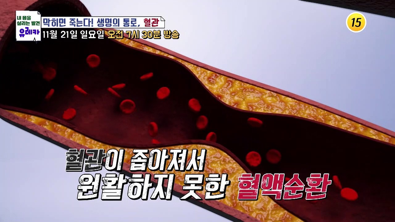 막히면 죽는다! 생명의 통로, 혈관_내 몸을 살리는 유레카 41회 예고 TV CHOS...