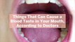 8 Things That Can Cause a Blood Taste in Your Mouth, According to Doctors