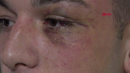 Son dakika gündem: Polisin 'dur' ihtarına uymayıp, yakalanan lise öğrencilerinden 'ters kelepçe' ve 'dayak' iddiası
