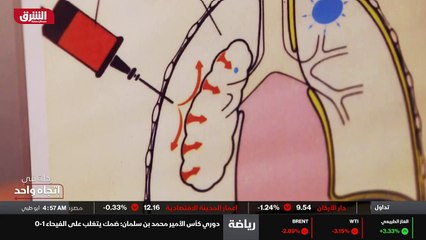 ...والجدار الصدري انه ضد بسيط فعلا...