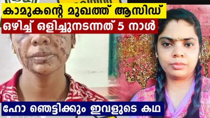 ഭർത്താവിനോട് പറഞ്ഞത് കഞ്ഞിവെള്ളം വീണ് പൊള്ളിയതാണ്..ഷീബയുടെ ഞെട്ടിക്കും കഥ