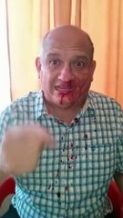 Elecciones 21N: Denuncian agresiones en San Francisco, Zulia