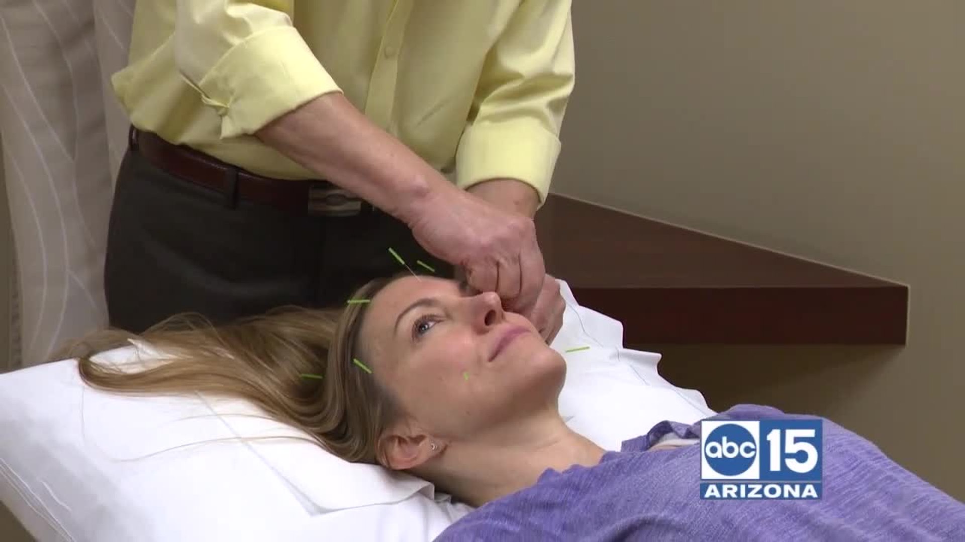 ⁣Dr. Yang Ahn of The Ahn Clinic for Medical Acupuncture treats Migraines, Irritable Bowel Syndrome &a