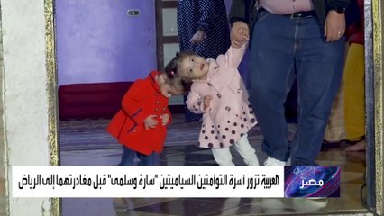 التوأم الملتصق سارة وسلمى إلى الرياض.. لإجراء جراحة الفصل