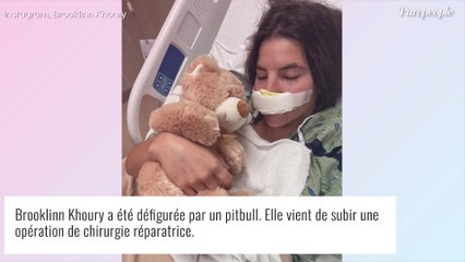 Défigurée par un pitbull, une influenceuse subit une opération et dévoile son visage