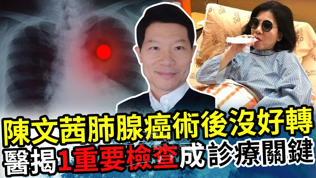 陳文茜肺腺癌術後沒好轉 醫揭「1重要檢查」成診療關鍵