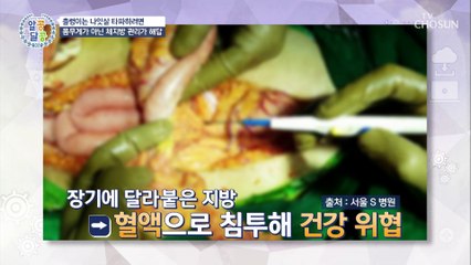 출렁이는 나잇살을 빼려면 몸속 체지방을 관리가 필수 TV CHOSUN 20211125 방송