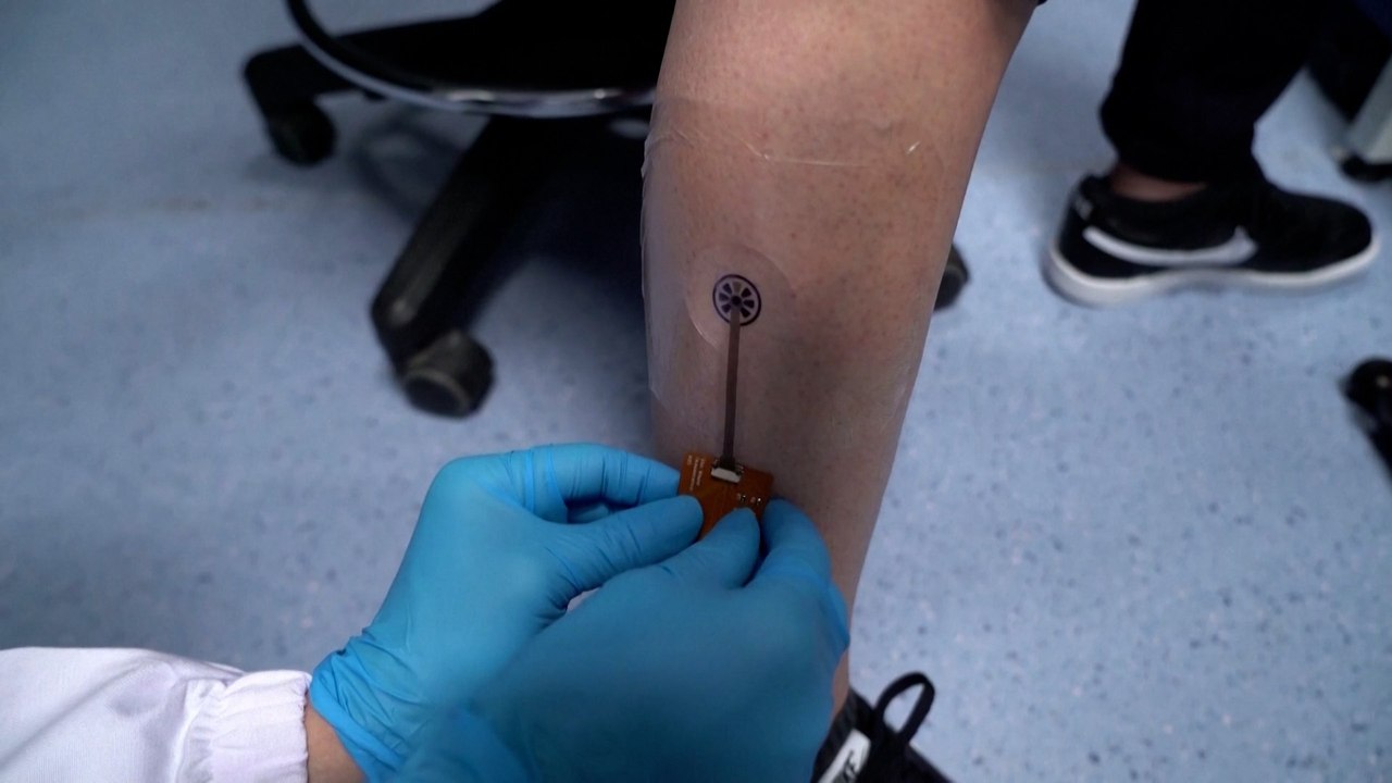 Singapore scientists develop smart bandage that tracks wounds via an app