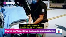 Recién nacida sufre quemaduras en cunero de hospital de Aguascalientes