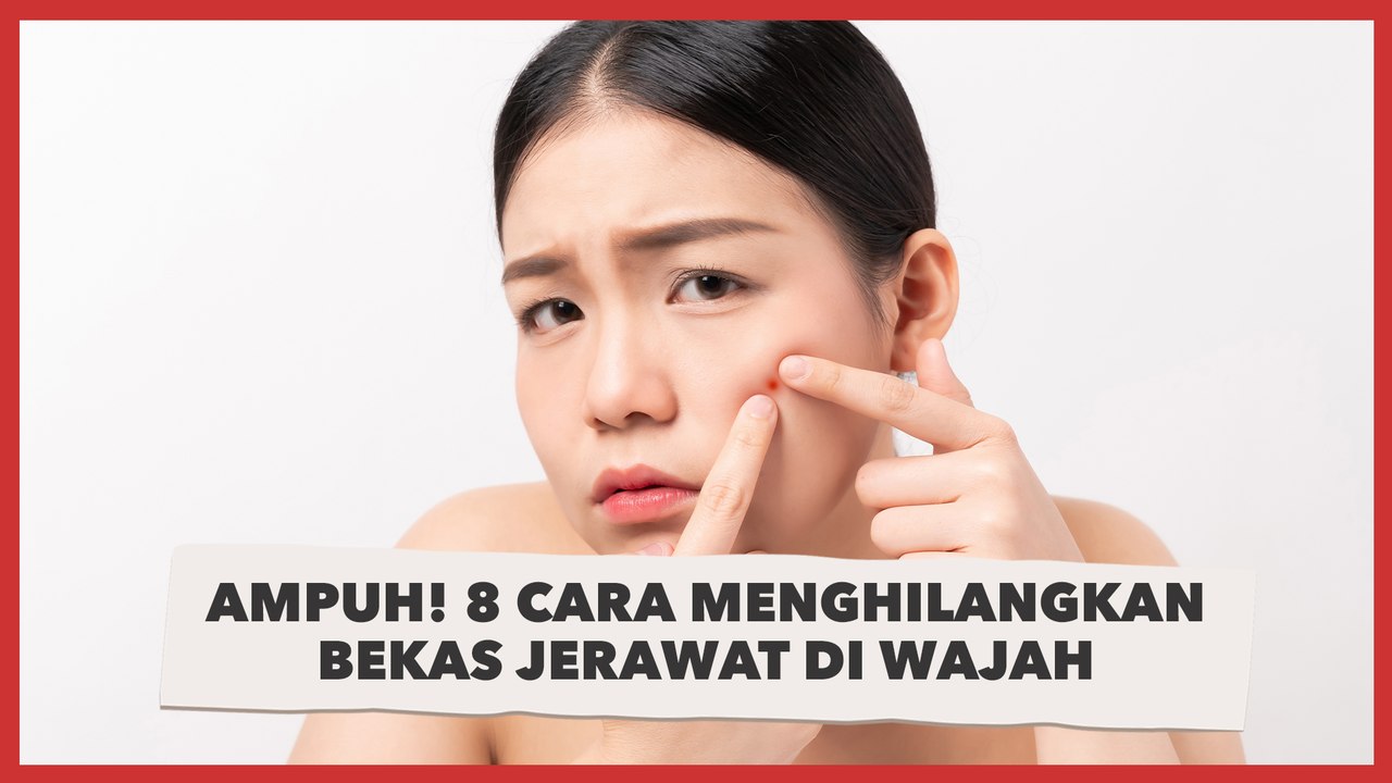 Ampuh! 8 Cara Menghilangkan Bekas Jerawat di Wajah, Andalkan Bahan Aktif hingga Laser