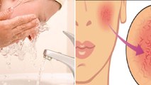 गर्म पानी से चेहरा धोने से क्या होता है, Face Dry से लेकर Wrinkles तक का खतरा | Boldsky