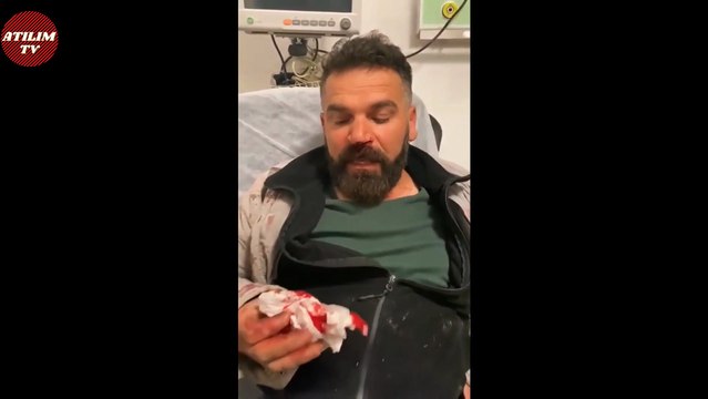 AKP’li Ağrı Belediye Başkanı Savcı Sayan, İki İşçiyi Dövdü !