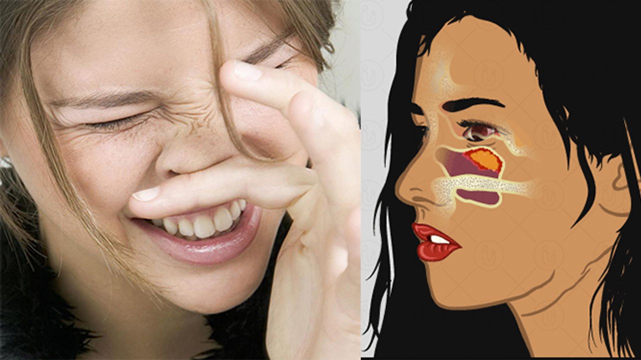 नाक में खुजली हो तो क्या करें | नाक में खुजली क...
