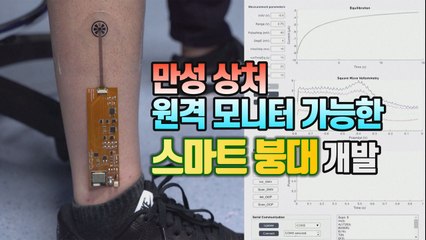 [세상만사] 만성 상처 원격 모니터링 가능한 스마트 붕대 개발 / YTN